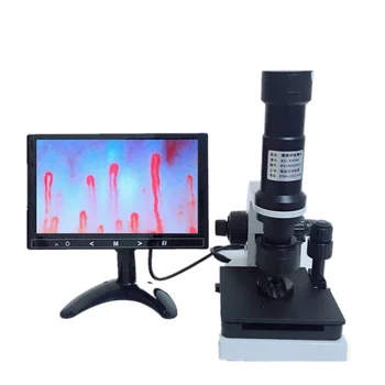 На Едро Преносими Led Дисплей NailFold Video Capillaroscopy Микроциркуляция Кръв, Капилярна Микроскоп